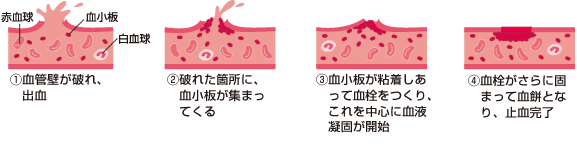 血管壁が破れ出血した後、破れた箇所に血小板が集まってくる。血小板が粘着しあって血栓をつくり、これを中心に血液凝固が開始。血栓がさらに固まって血餅となり、止血が完了する。